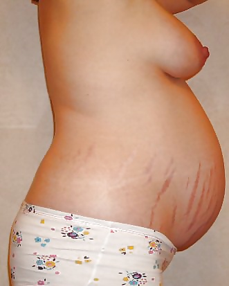 Nackte Schwangere Bauch - Nackten Schwangeren Bauch 4 #32914913