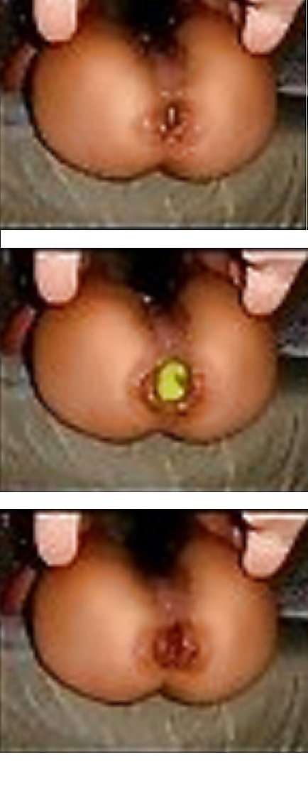 Mis inserciones de bolas
 #36661775