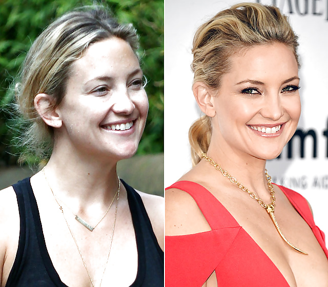 Kate hudson mega collezione. 
 #28631420