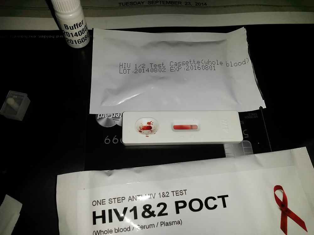 私のhivテスト
 #29262227