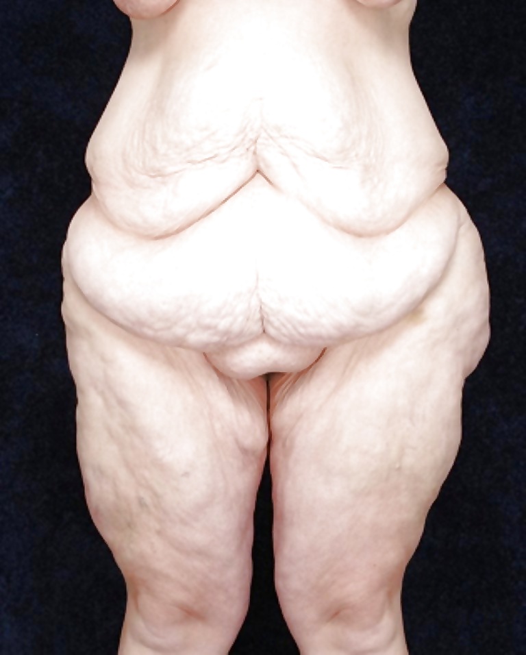 女性の脂肪組織を愛しています パート3
 #40478418