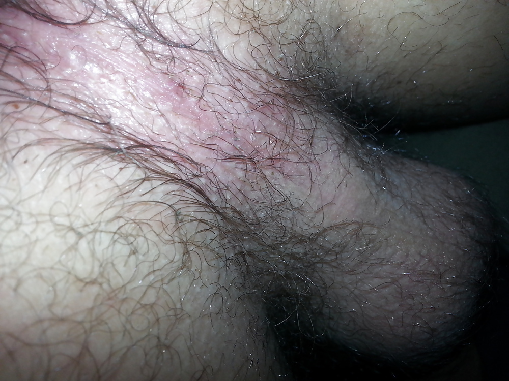 My Hairy Fucking Ass #26220270