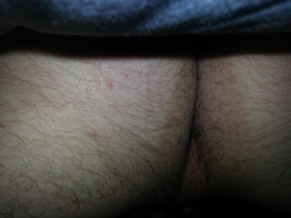 My Hairy Fucking Ass #26220276