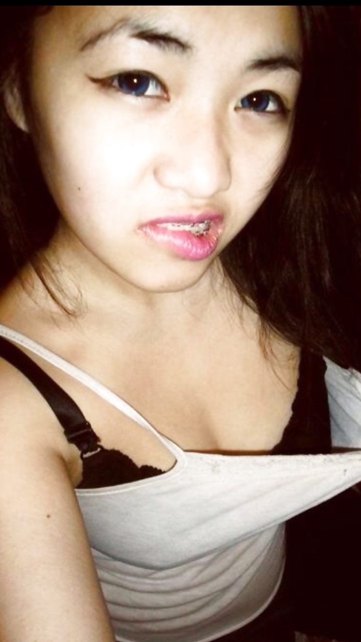 7 mly bite
 #28896722