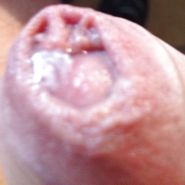 Pre-cum