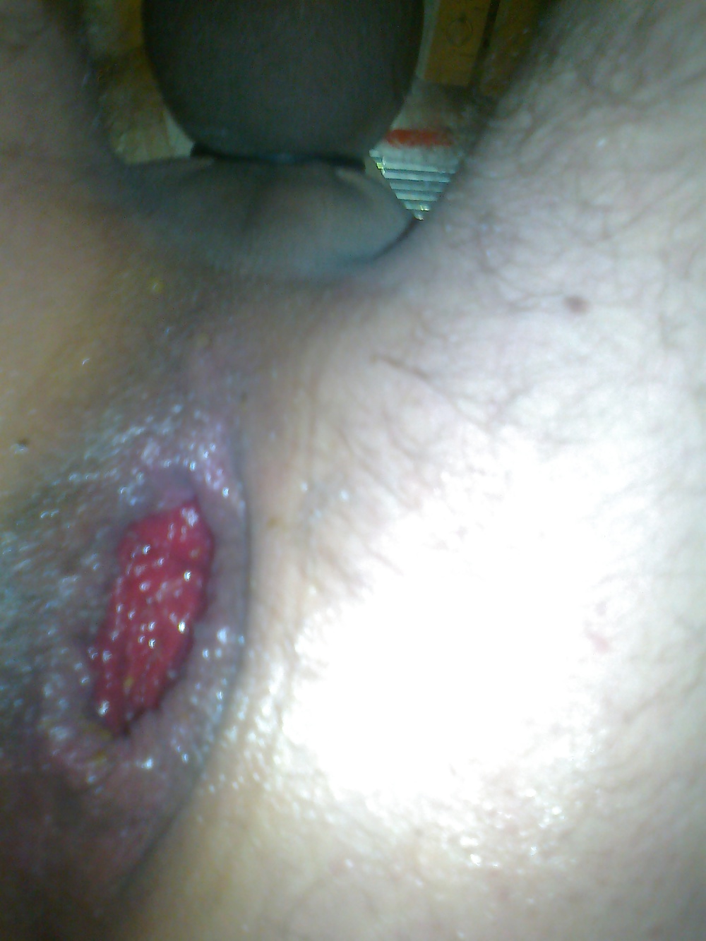 フィスティング
 #31031461