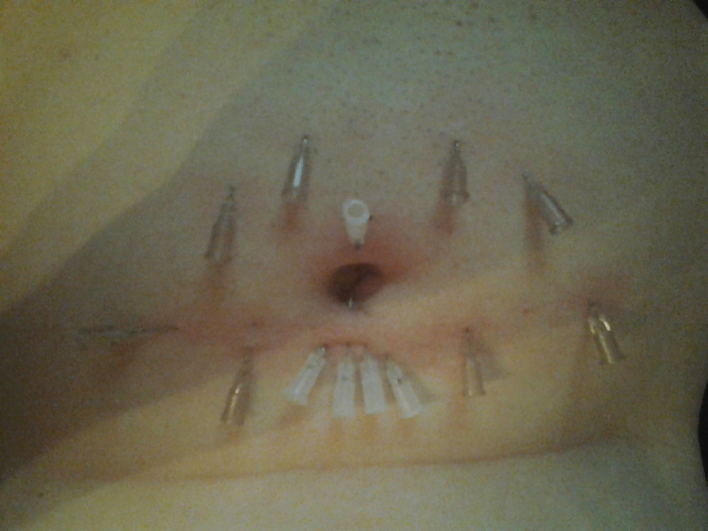 Nadel Klemmt Mich #23910579