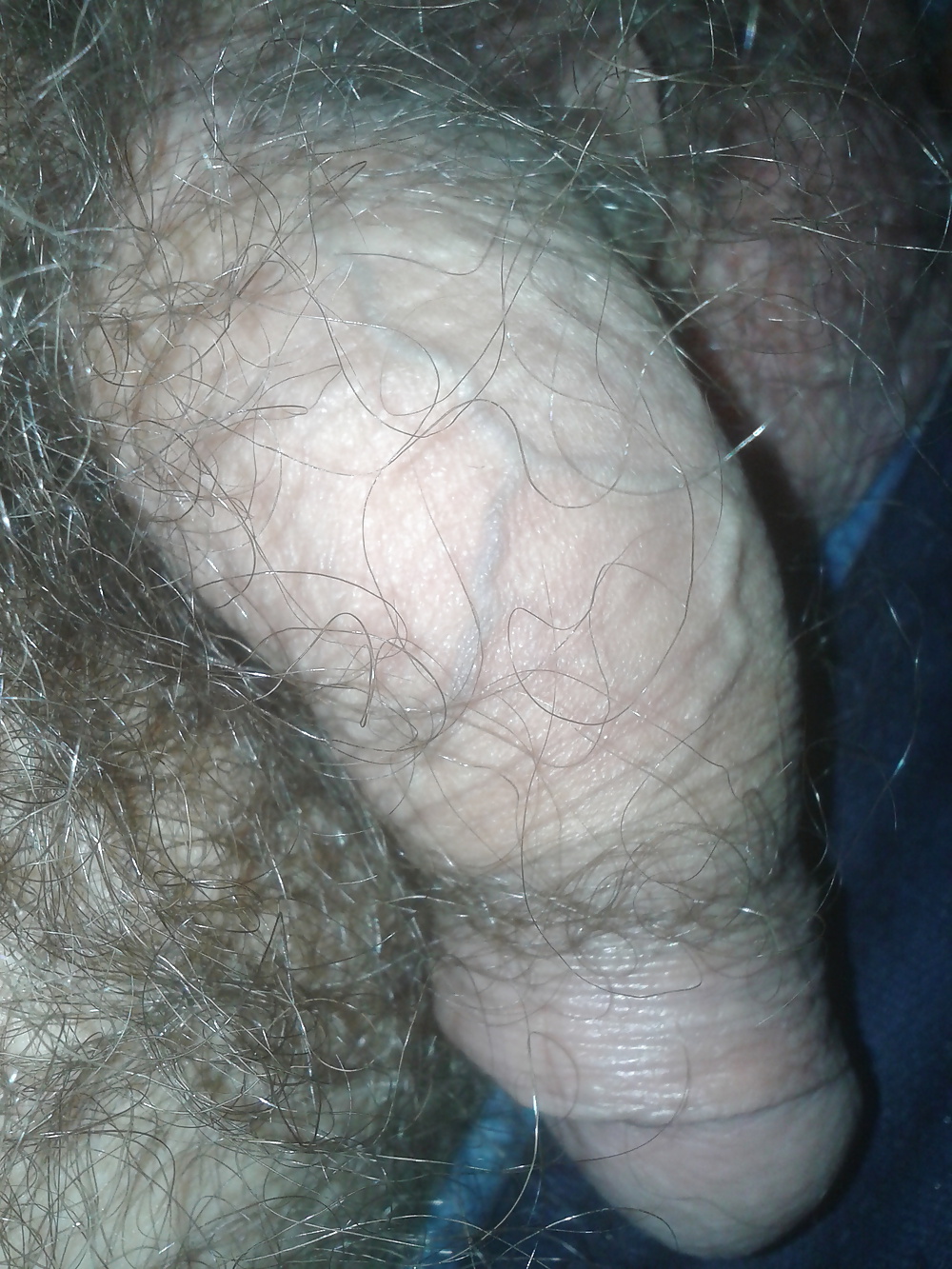 2014
 #25879633
