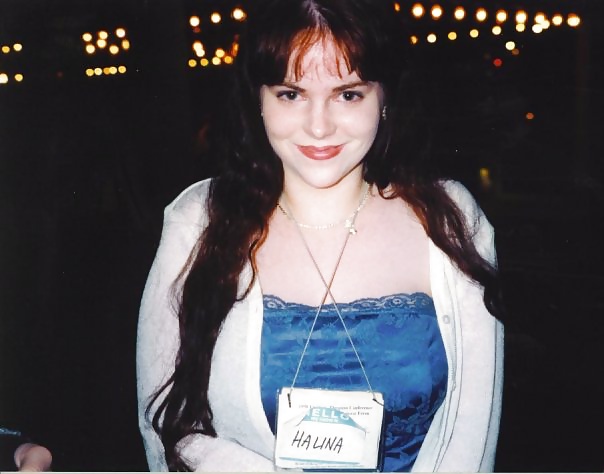 Younger years, college, and when i was nearly bald #34850228