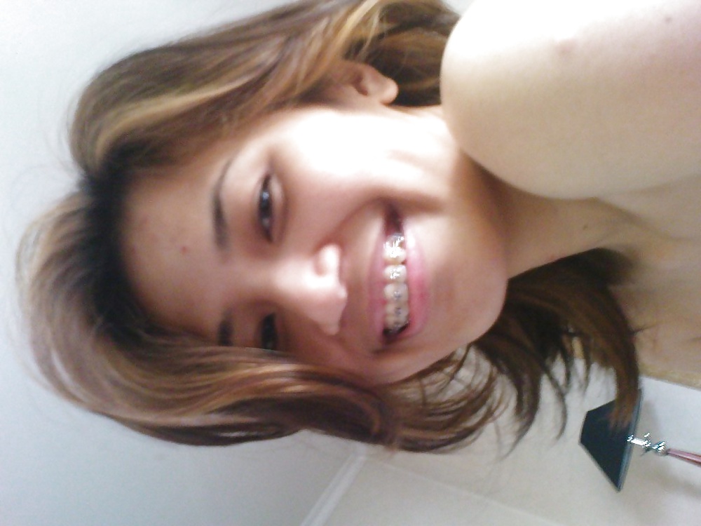 Malay girl with braces #34230164