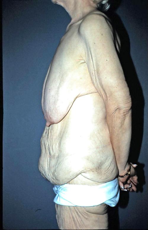 Why change the body part 8 #24741374