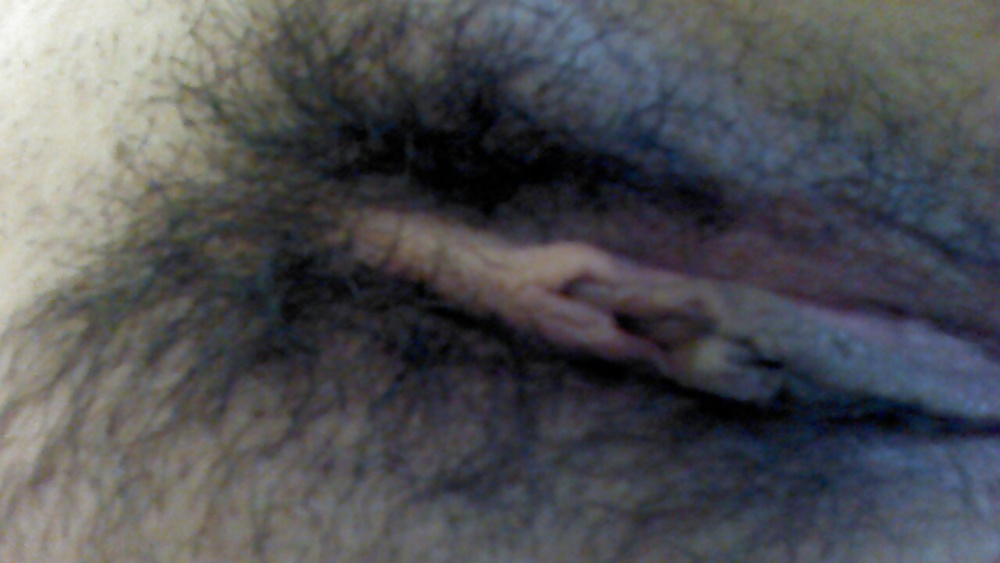 Bicho peludo
 #31340359