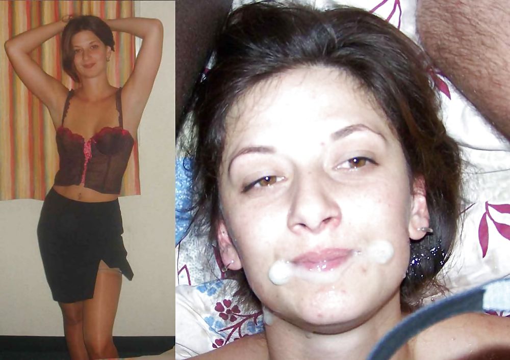 Prima e dopo il trattamento del viso 2
 #24219253