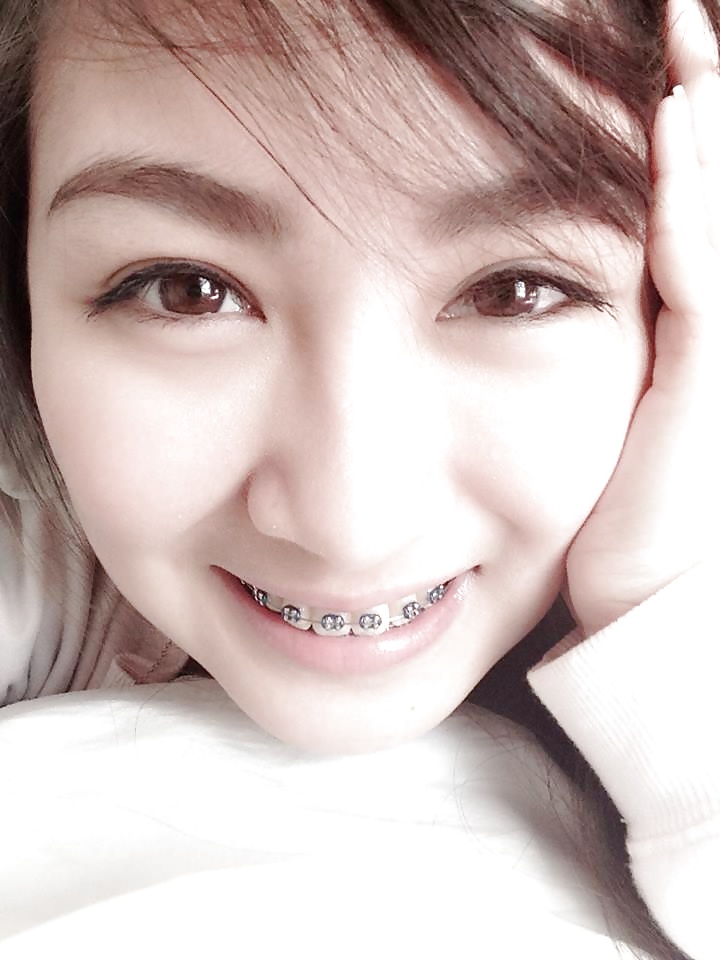 Simple significa más caliente
 #34502365