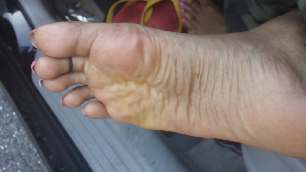 Pink toes 
 #35950409