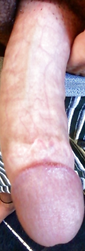 Primer plano
 #35647372