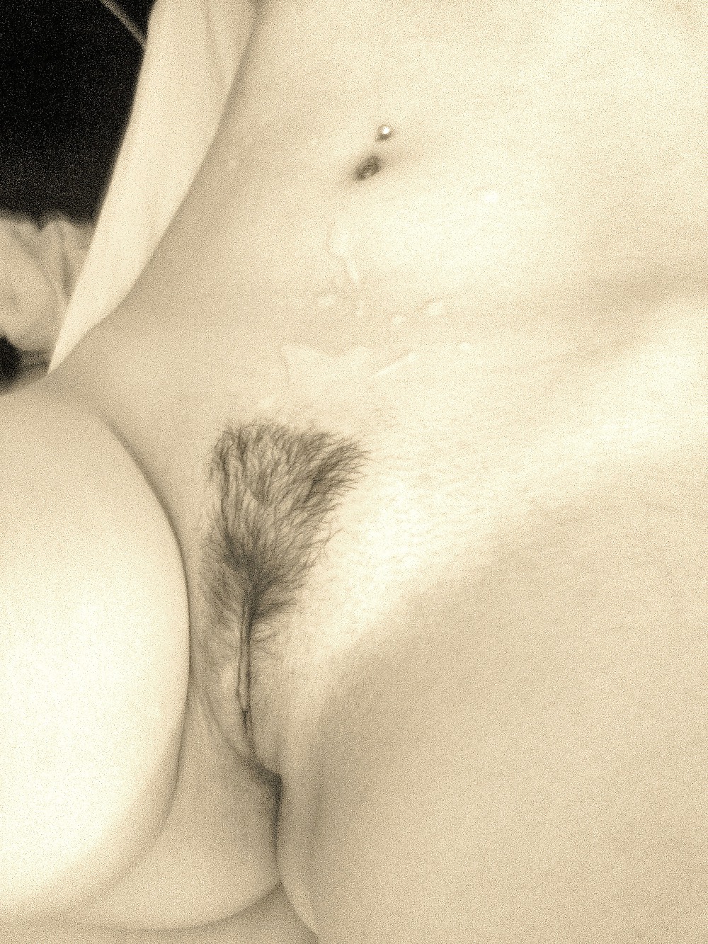 Before and After #35806266