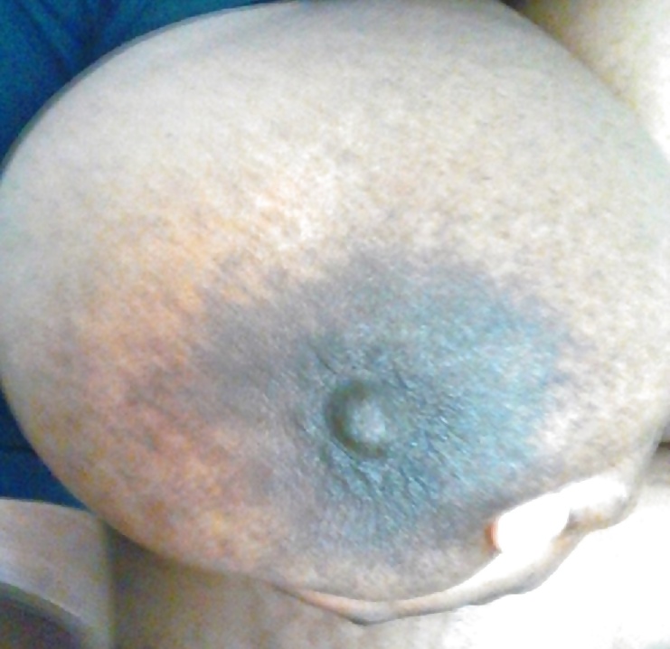 Areolas negras grandes parte 33
 #38559593