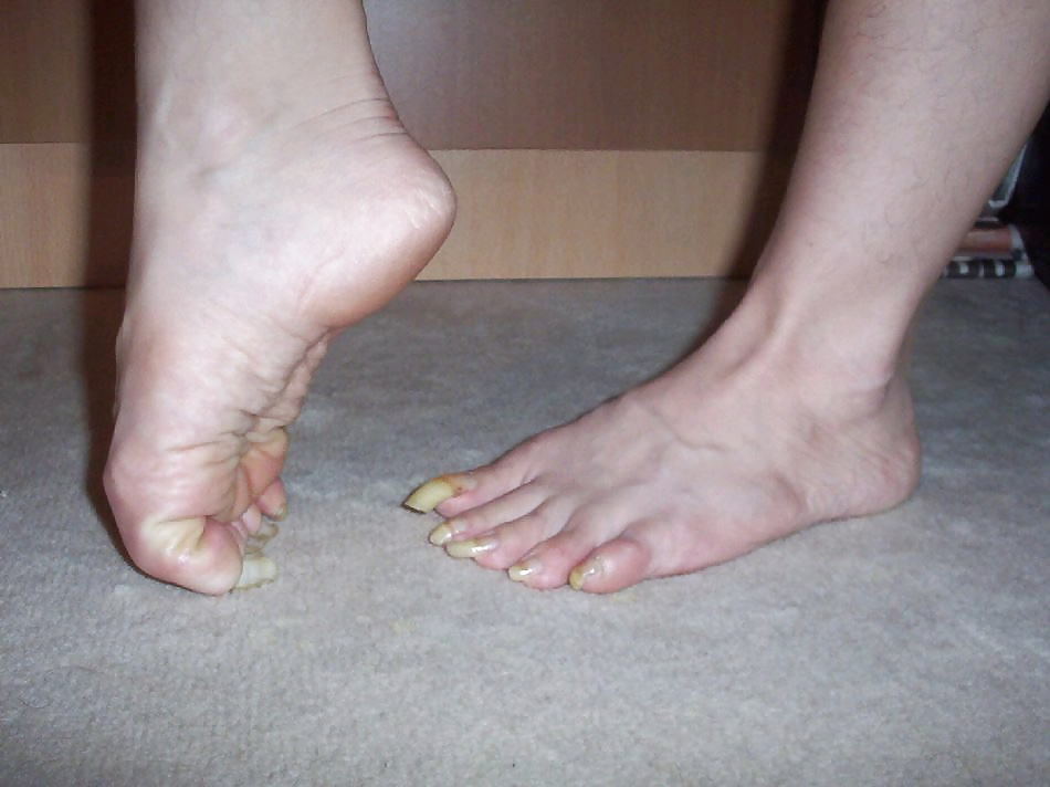 Uñas de los pies largas
 #30478870