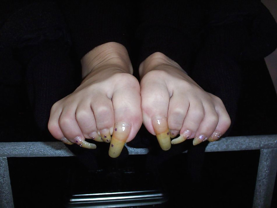 Long Toenails #30478896