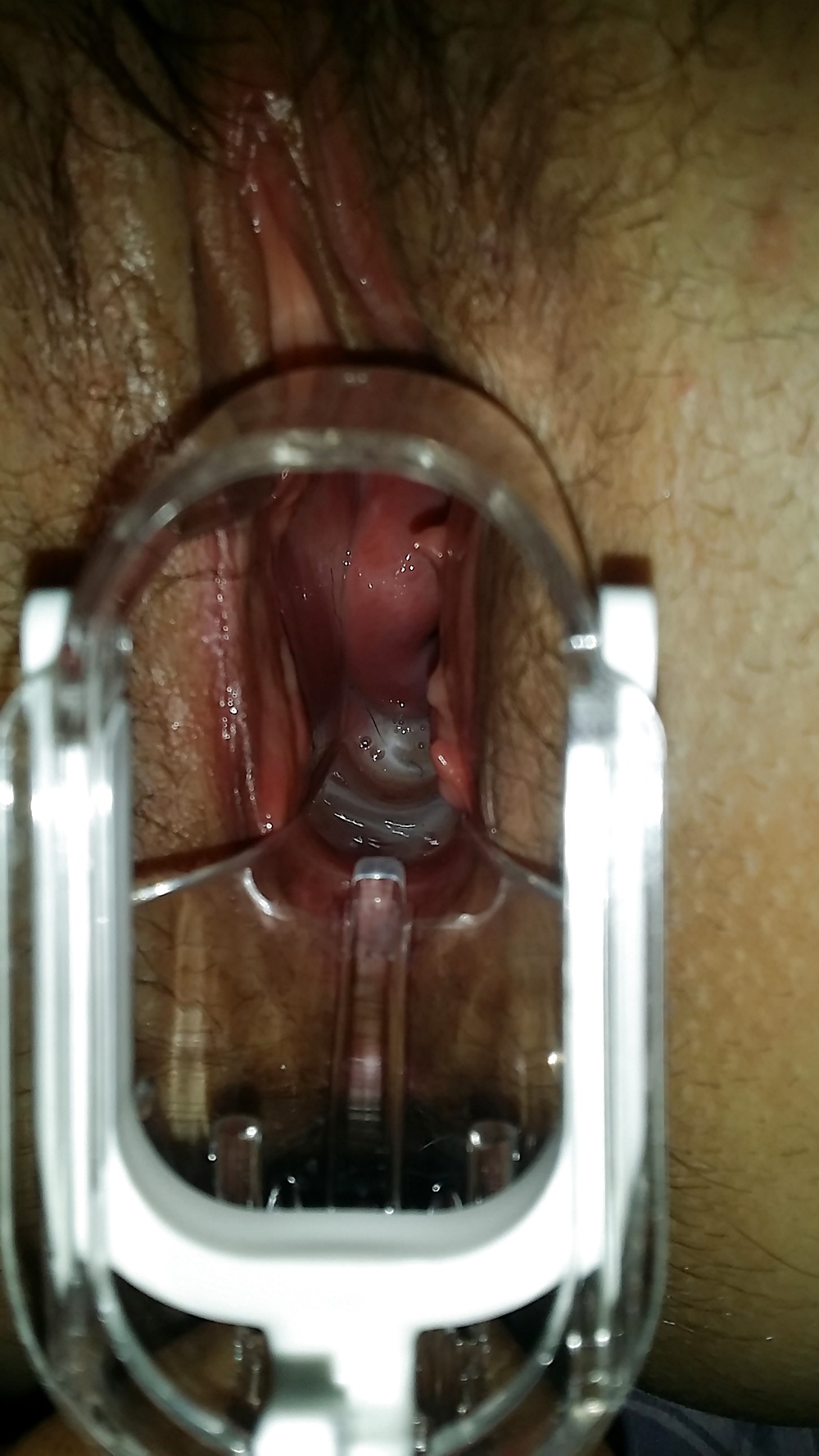 ジェンナ
 #31202610