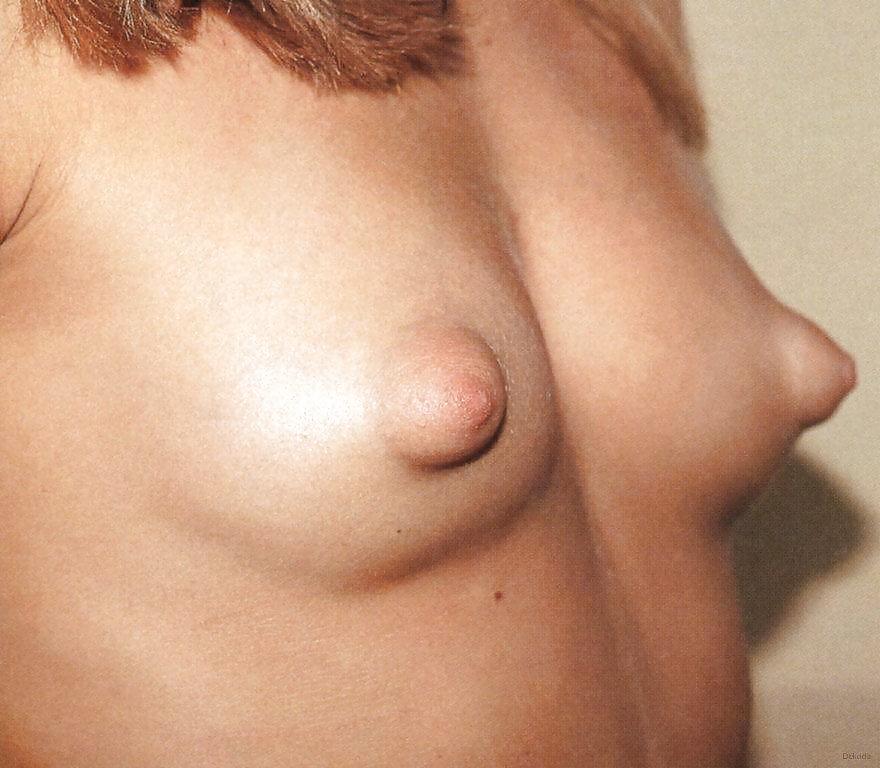 Puffy nipples #31709146