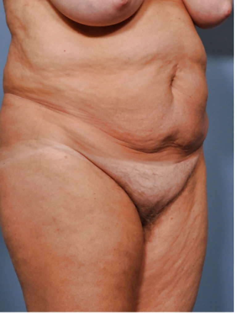 Types of bodies that excite part 8 #32259396