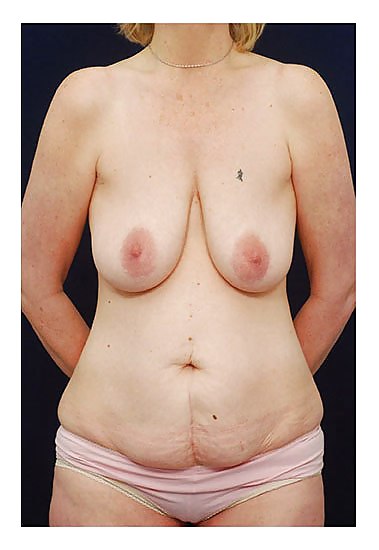 Why change the body part 7 #35831674