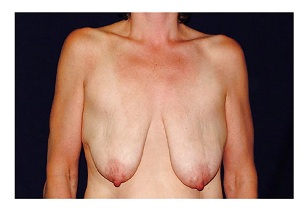 Why change the body part 7 #35831684