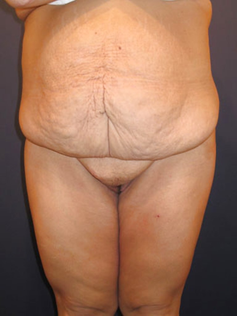 Why change the body part 7 #35831690
