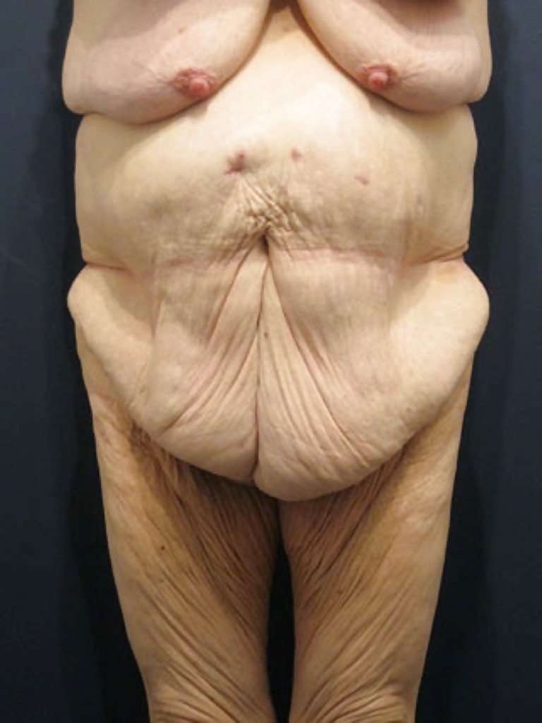 Why change the body part 7 #35831697