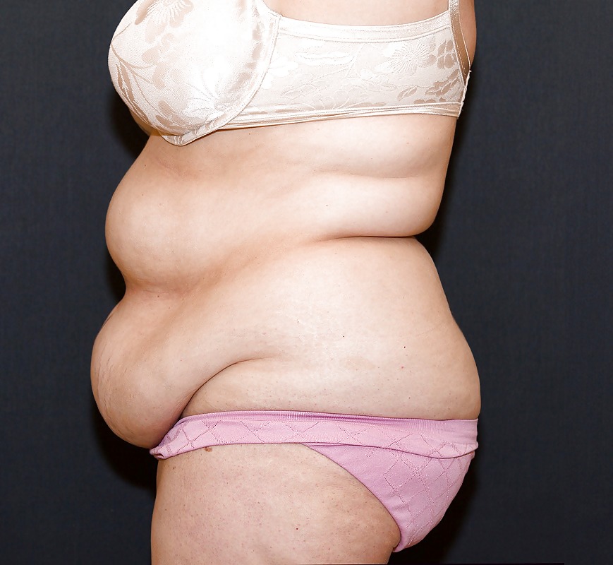 Why change the body part 7 #35831710