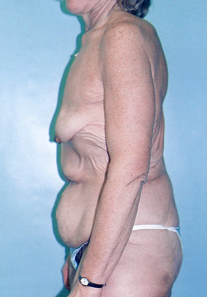 Why change the body part 7 #35831715