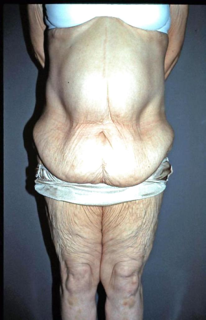 Why change the body part 7 #35831731