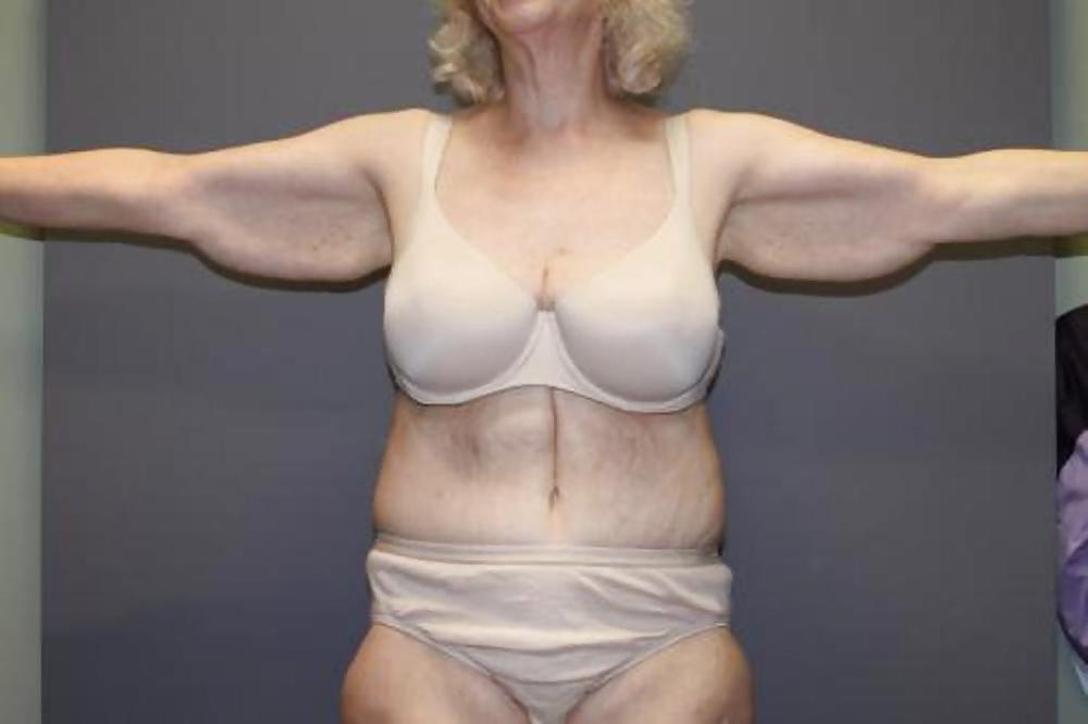 Why change the body part 7 #35831733