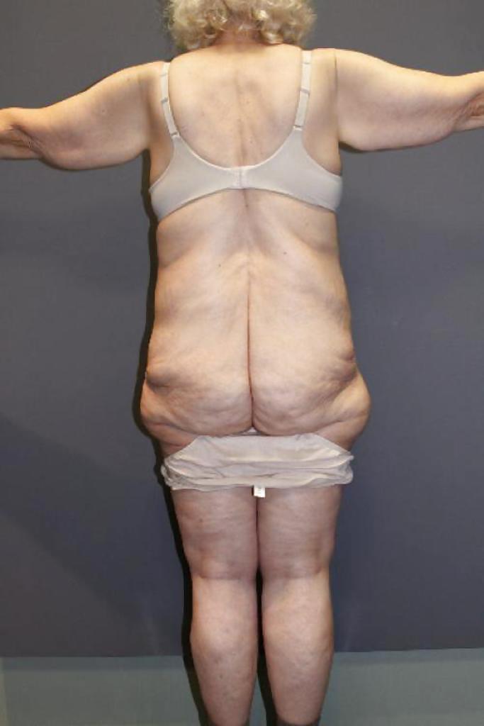 Why change the body part 7 #35831736