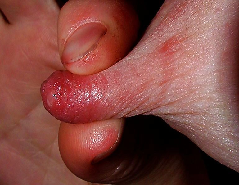 私の果物
 #34579326