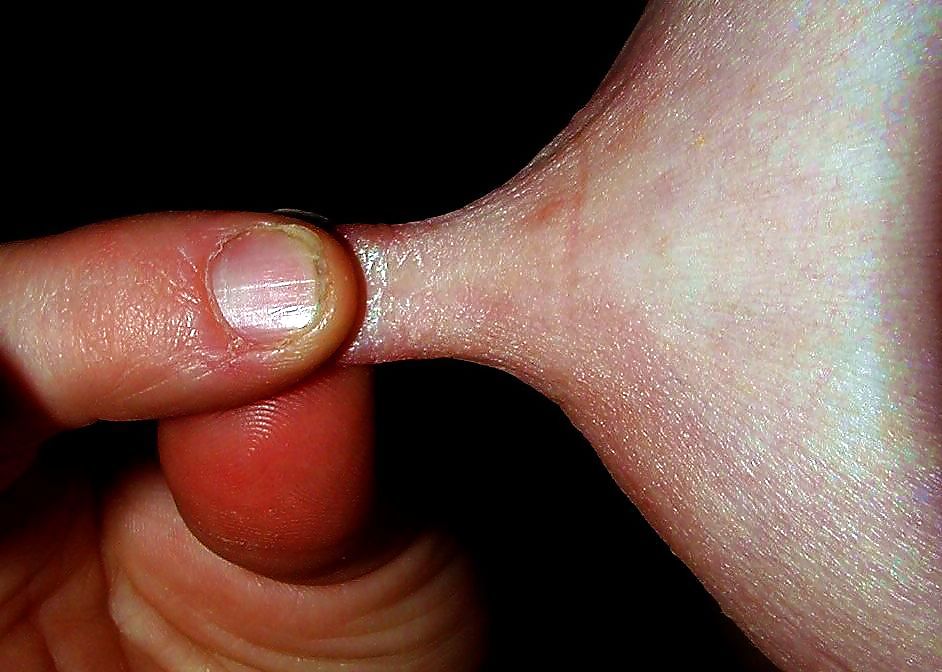 私の果物
 #34579328