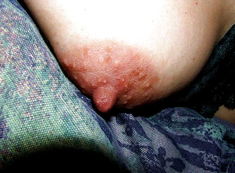 私の果物
 #34579330