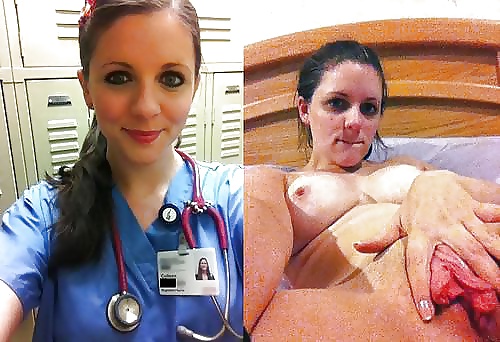 154- BEFORE AND AFTER 6 #33679396