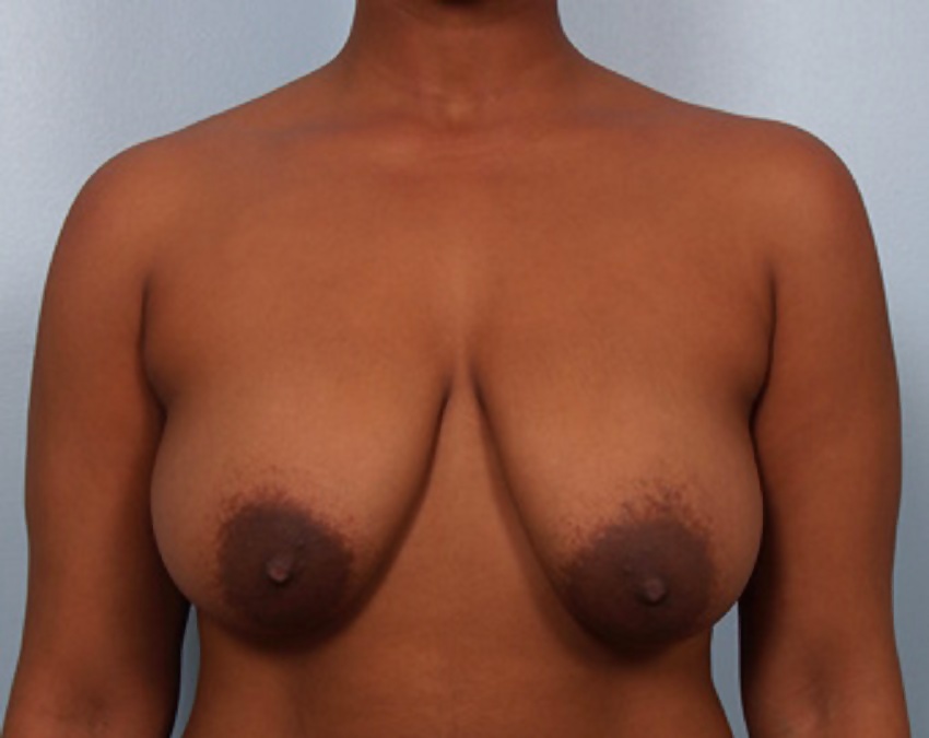 Big black areolas ----massive collection---- part 26  #27776460