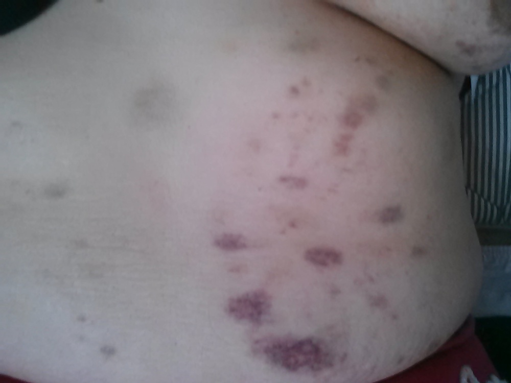 Bitten and Whipped #34896381
