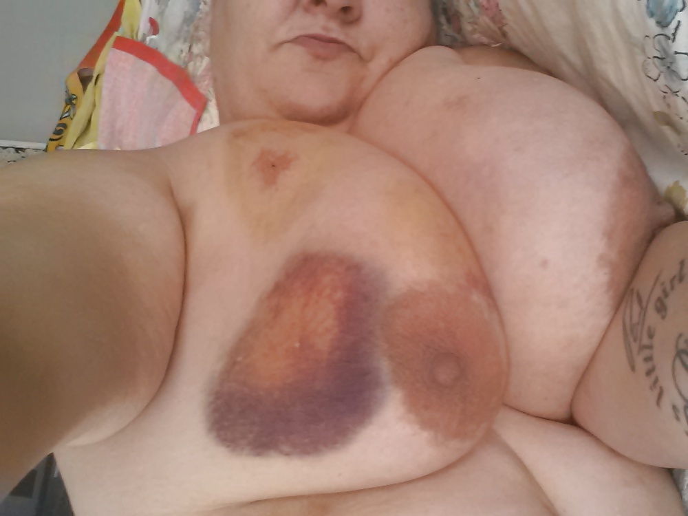 Bitten and Whipped #34896387