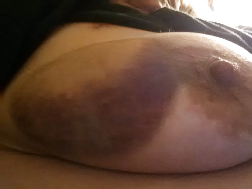 Bitten and Whipped #34896395