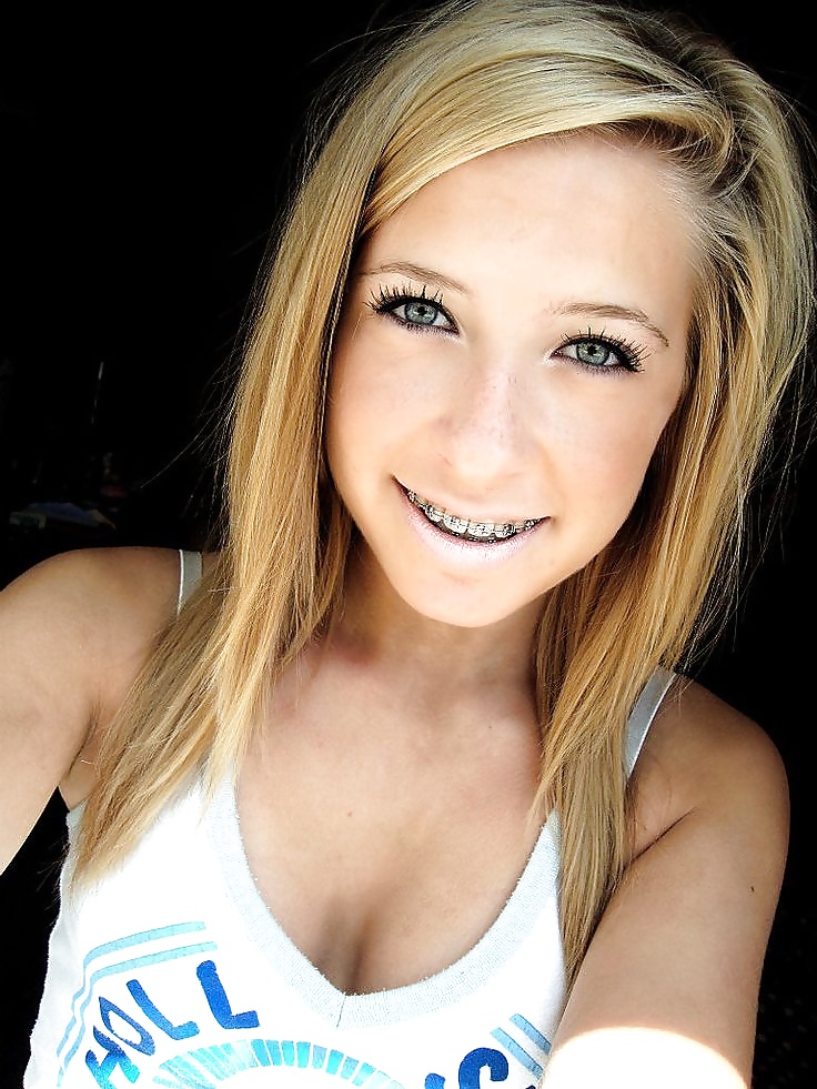 Teens With Braces 2 #25477730