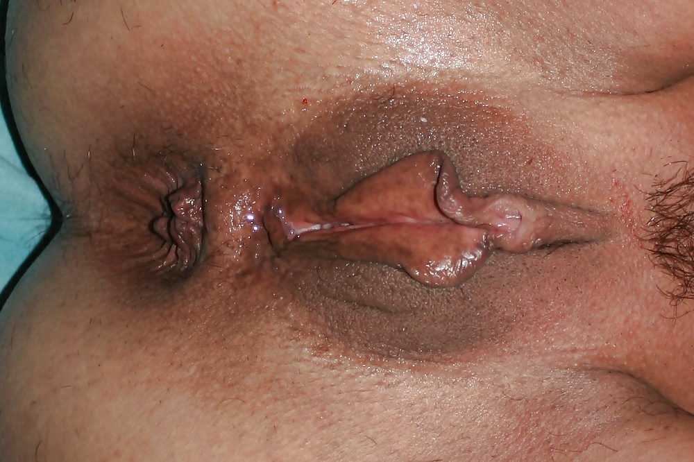 Rosette 31 #31500393