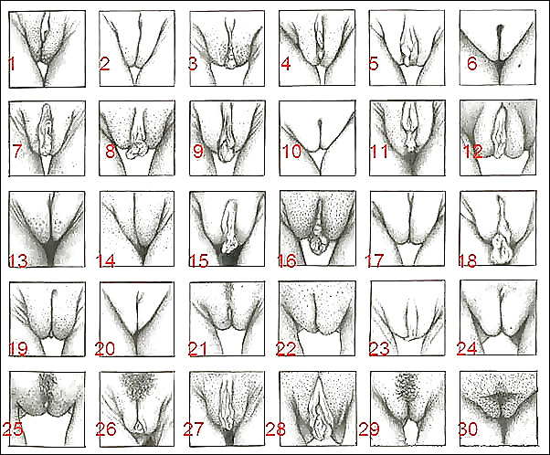 Descripciones
 #35860178