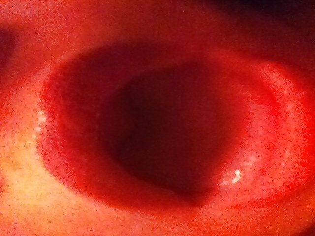 Some of me #26384306