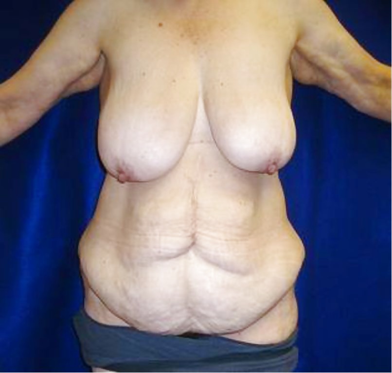 Types of bodies that excite me part 15 #40575488