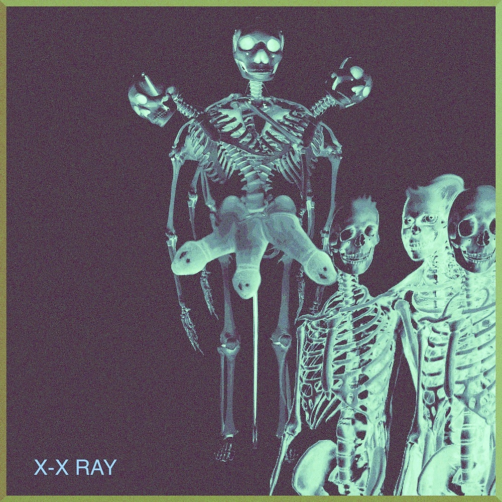 X-x-ray
 #29289796